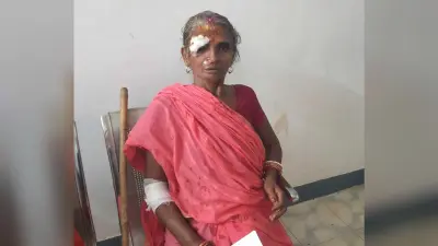 दो बाइक की टक्कर में महिला समेत तीन लोग हुए घायल