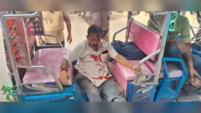 बाइक की टक्कर से एक व्यक्ति गंभीर रूप से घायल