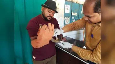 सर्प मित्र ने जख्मी कोबरा का रेस्क्यू कर कराया इलाज