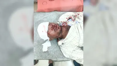 सड़क दुर्घटना में बाइक चालक जख्मी, रेफर