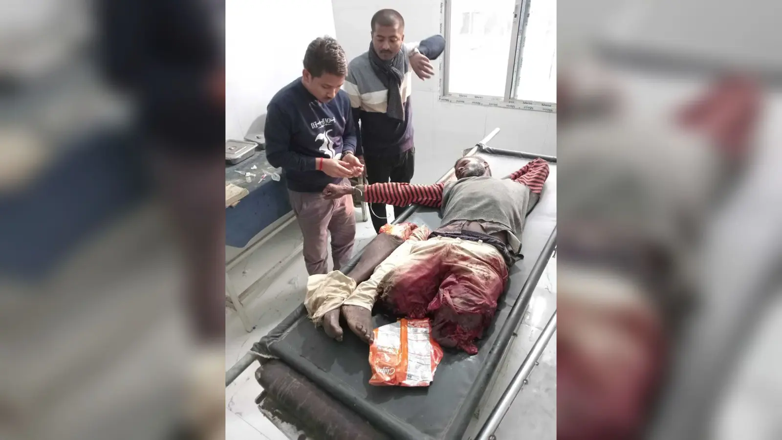त्रिपुरा से मजदूरी कर नालंदा घर लौट रहे मजदूर का ट्रेन से कटा दोनों पैर
