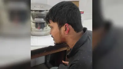 सीतारामडेरा : घर के पास नशा करने से रोका, तो युवक का कान काटा