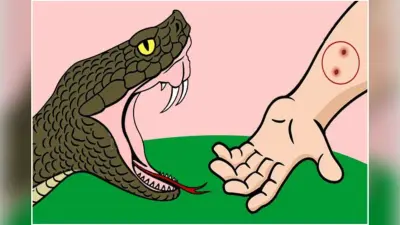 West Bengal : सर्पदंश की नयी दवा ने जगायी उम्मीद ,मौतों पर लगेगा अंकुश