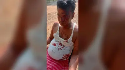 जमीन विवाद में पड़ोसी ने युवक पर किया जानलेवा हमला, भर्ती