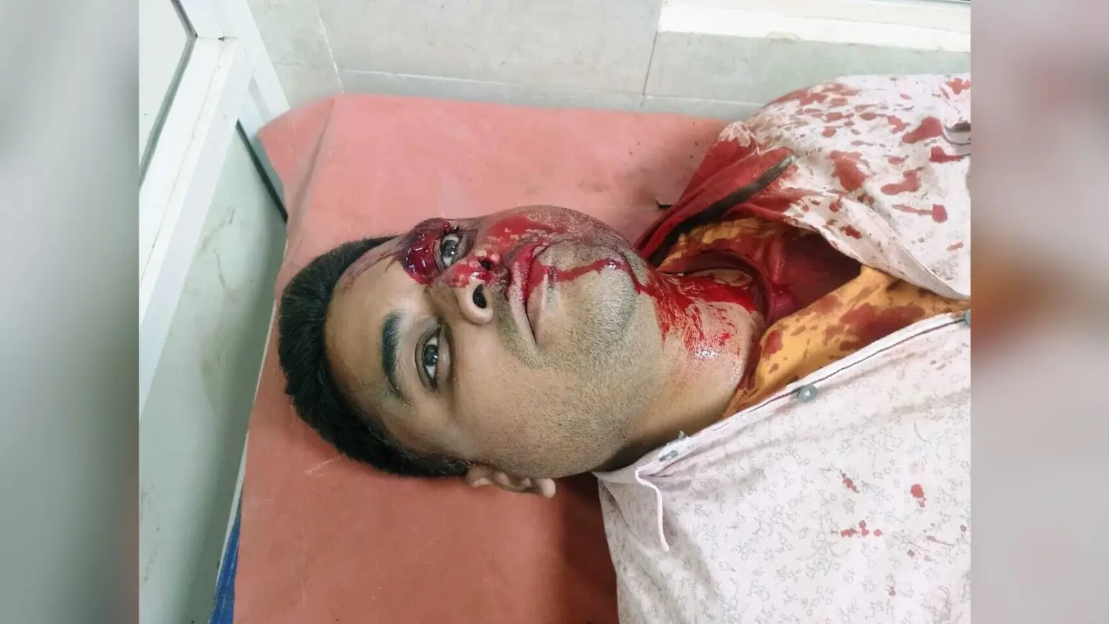 भूमि विवाद को लेकर हुई मारपीट, आधा दर्जन से अधिक लोग घायल, इलाजरत