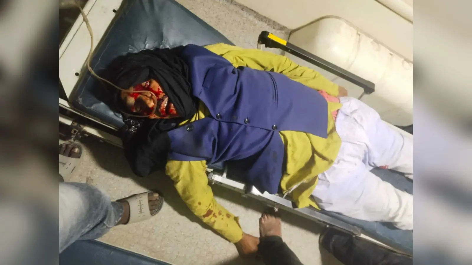 बाइक व साइकिल में टक्कर एक की मौत, दूसरा रेफर