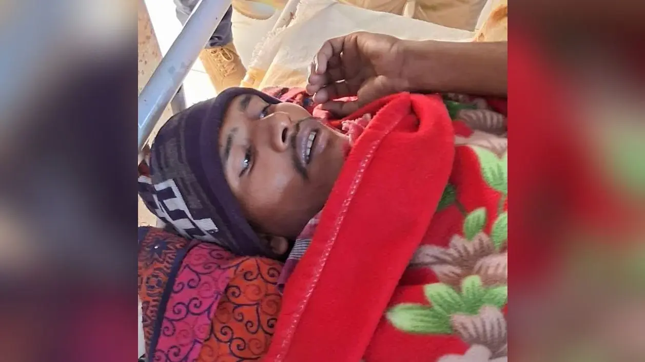 पत्नी से विवाद होने पर पति ने खुद को लगायी आग, सदर अस्पताल में चल रहा इलाज
