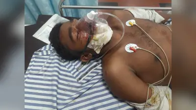 Dhanbad News: भूली में ट्रैक्टर व कार में टक्कर, दो घायल