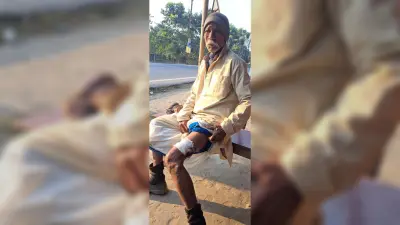 जंगली सुअर के हमले से पांच लोग जख्मी, लोगों में भय का माहौल