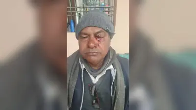 Bhagalpur news हाजिरी बनाने को लेकर एचएम और सहायक शिक्षक में मारपीट