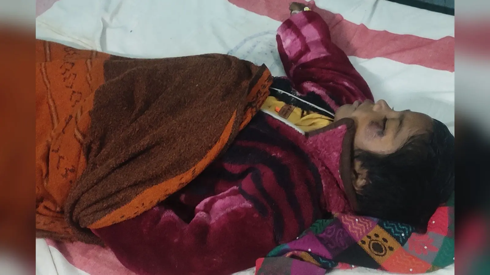 थ्रेसर की ठोकर से बच्चा गंभीर रूप से घायल, रेफर