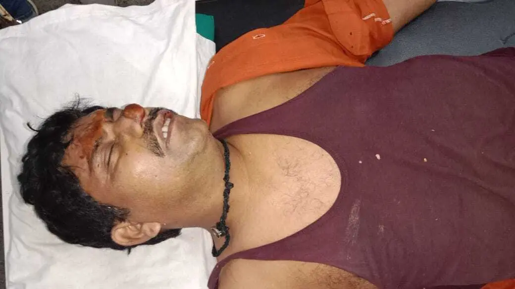 Chaibasa News : स्कूटी-टेंपो में भिड़ंत से एक की मौत, तीन गंभीर