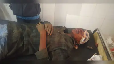 Accident : राह चलते युवक को बाइक सवार ने मारी टक्कर, तीन जख्मी