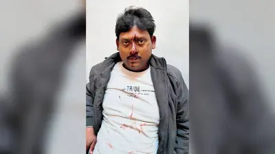 Dhanbad News : दुष्कर्म के आरोपी कोलकर्मी के भाई व जीजा का लोगों ने नाक-मुंह तोड़ा