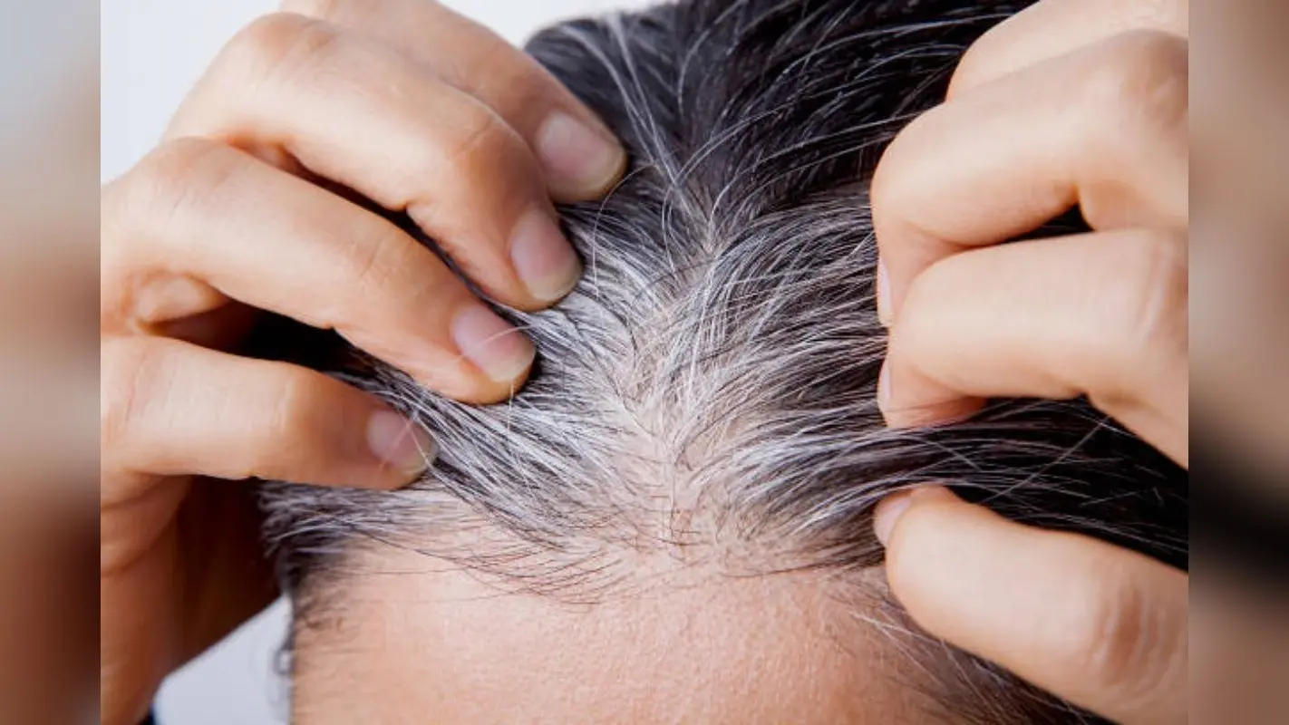White Hair: बालों की बनी रहेगी काली रंगत, अब नहीं होंगे सफेद, बस डाइट में शामिल करें ये चीजें