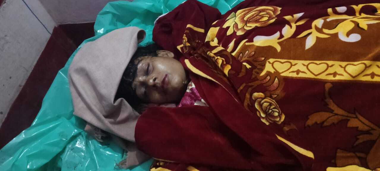 Dhanbad News : गोलकडीह में पुलिया के नीचे गिरी कार महिला की मौत, एक ही परिवार के चार बच्चे समेत आठ घायल