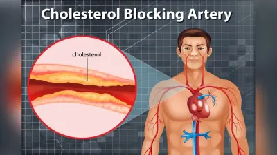 Health Tips:- आपके शरीर से बैड कोलेस्ट्रॉल हो जाएगा गायब ,आज से शुरू करें इन चीजों का सेवन
