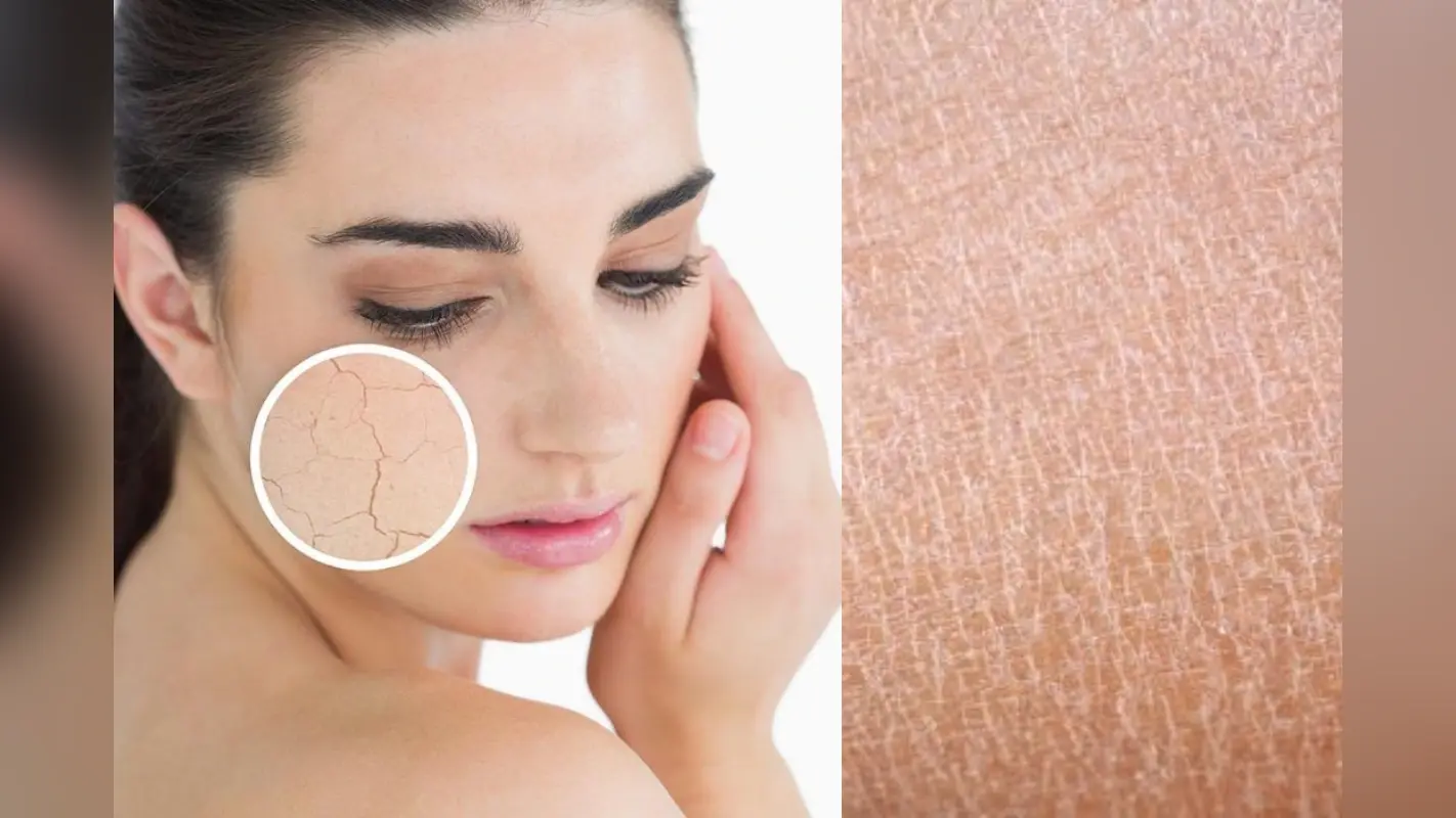 Dry Skin Care Tips: रूखी और थकी-थकी त्वचा को तुरंत बनाएं मुलायम और चमकदार