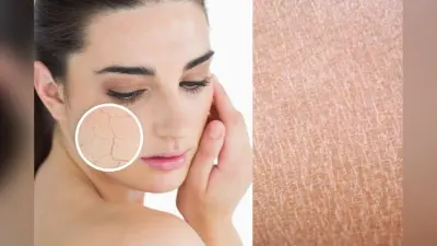 Winter Dry Skin Treatment : सर्दियों में ड्राई स्किन से छुटकारा पाने के आसान और असरदार घरेलू उपाय