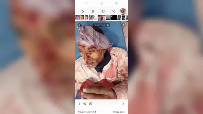 Bhagalpur news दो पक्षों में गोलीबारी, एक जख्मी, कट्टा व गोली के साथ तीन धराये