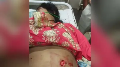 प्रेमिका को चाकू मारकर प्रेमी लाया मेडिकल दुकान, फिर हुआ मौके से फरार