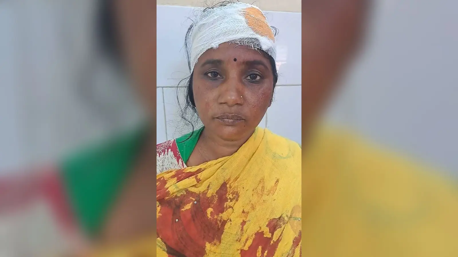 घरेलू विवाद में मारपीट, दो महिलाएं घायल
