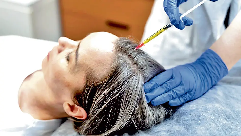 आपका ब्लड दिला सकता है गंजेपन से छुटकारा