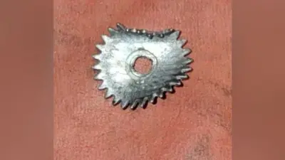 जीएमसीएच में सफलतापूर्वक निकाली गयी मासूम के कंठ में फंसी लोहे की चकरी