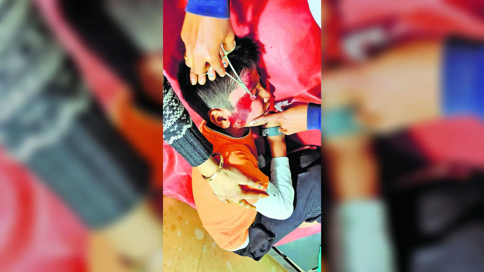 Rourkela News: बसंती कॉलोनी में कोचिंग जा रहे बच्चे को कुत्तों ने दौड़ाया, साइकिल से गिरकर घायल