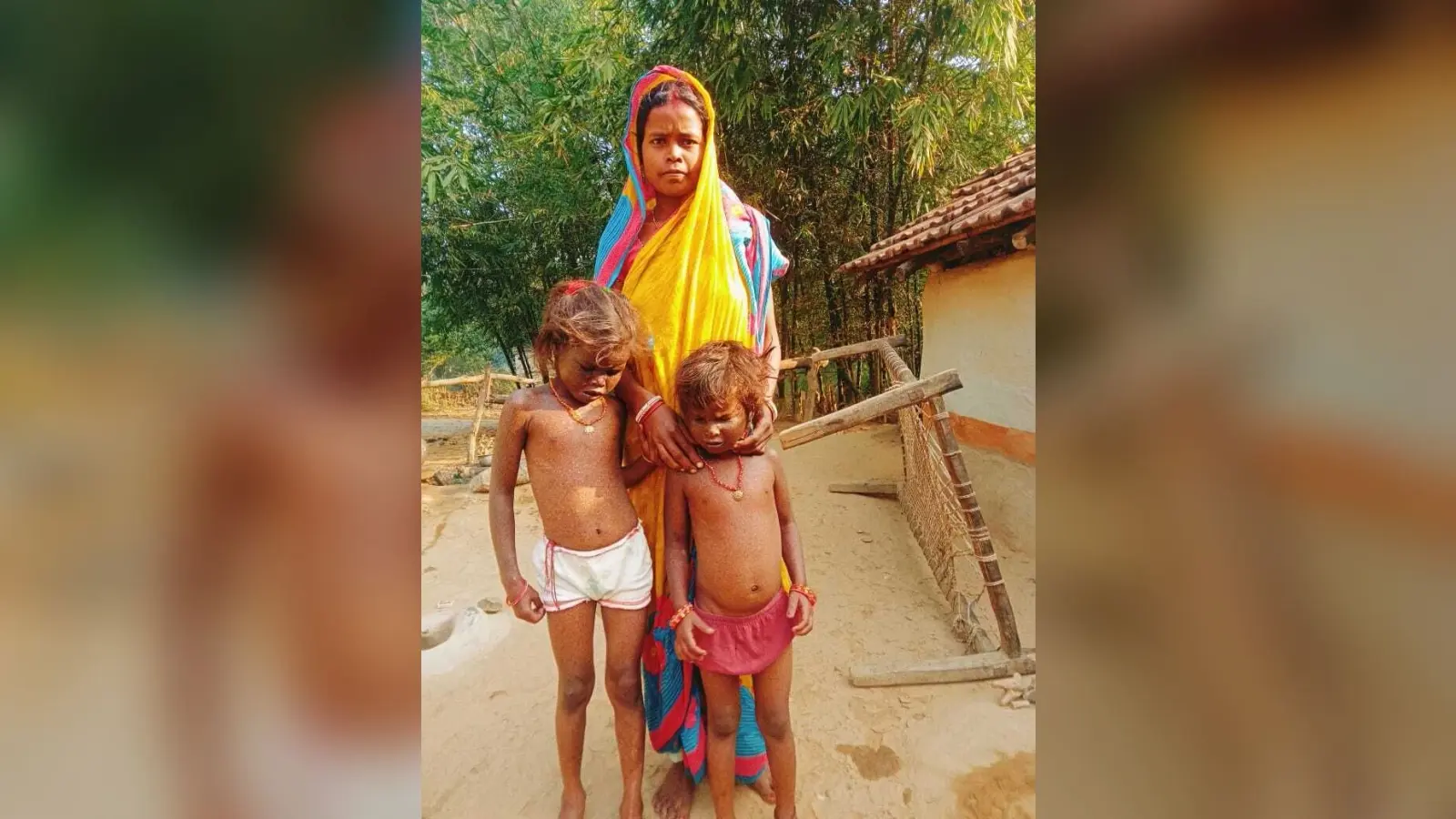 East Singhbhum news : धातकीडीह की दो सबर बच्चियां अज्ञात बीमारी से पीड़ित, इलाज में गरीबी बाधक