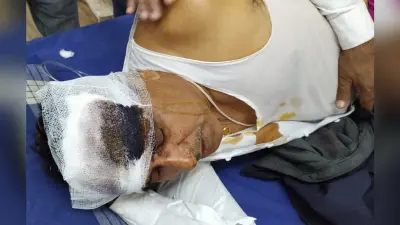 Bokaro News : अनियंत्रित कार पाेल से टकरायी, एक ही परिवार के छह घायल