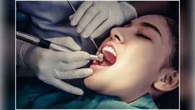 Cavity Home Remedies : दांतो में कैविटी से छुटकारा पाने के लिए बस लगा लें ये चीजें, चमक उठेगं आपके दांत