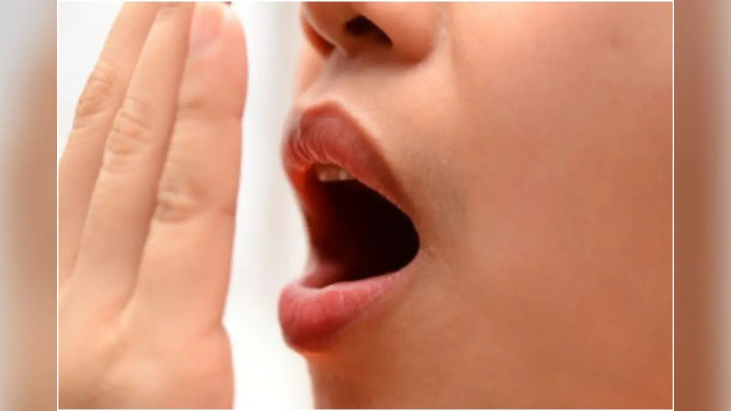Vitamin Deficiency Mouth Odor : जानें किन विटामिनों की कमी से मुंह से आती है दुर्गंध, कैसे पाएं छुटकारा