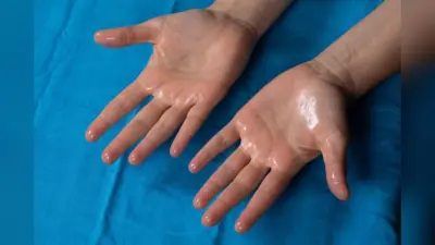 Hyperhidrosis: हथेली और तलवों में आता है हद से ज्यादा पसीना? हो सकता है हाइपरहाइड्रोसिस