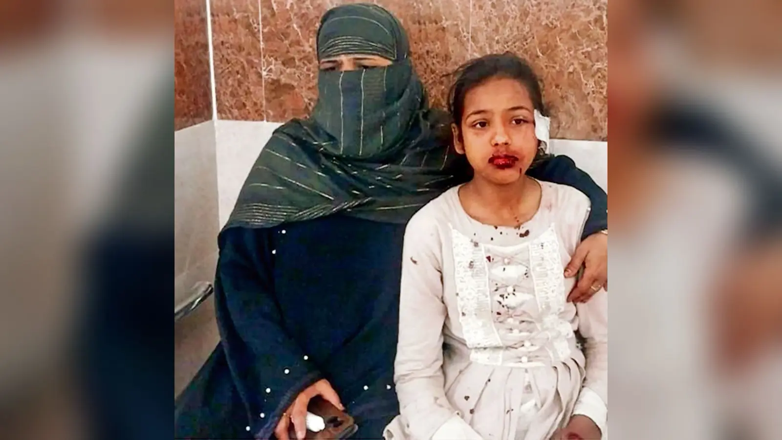Siwan News : कार ने बाइक सवार सहित चार लोगों को रौंदा, एक की मौत