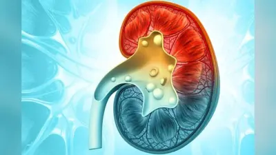 Prevention of Kidney Stone: इन 5 आदतों को अपनाकर किडनी स्टोन के खतरे को कम करें