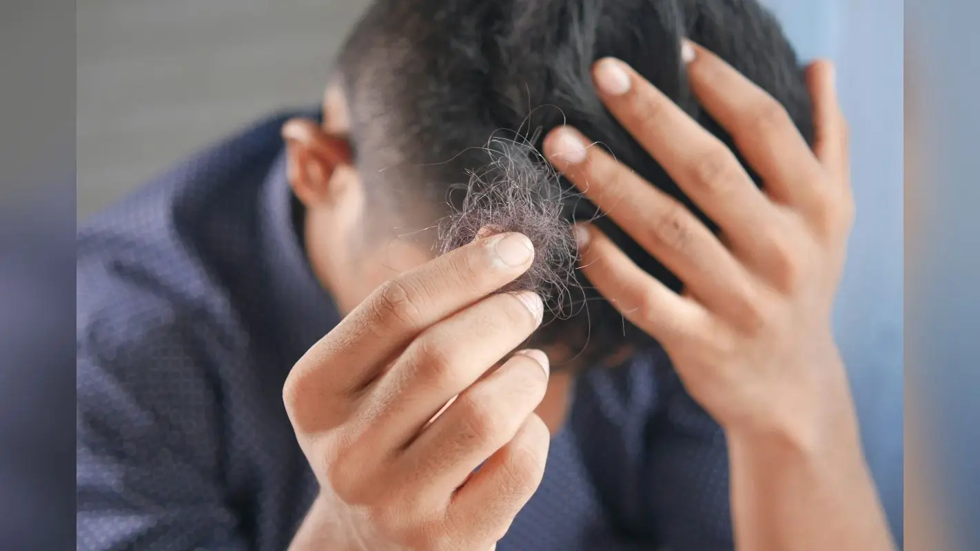 Hair Care Tips: कहीं इन गलतियों की वजह से तो गंजे नहीं हो रहे हैं आप? समय रहते करें सुधार