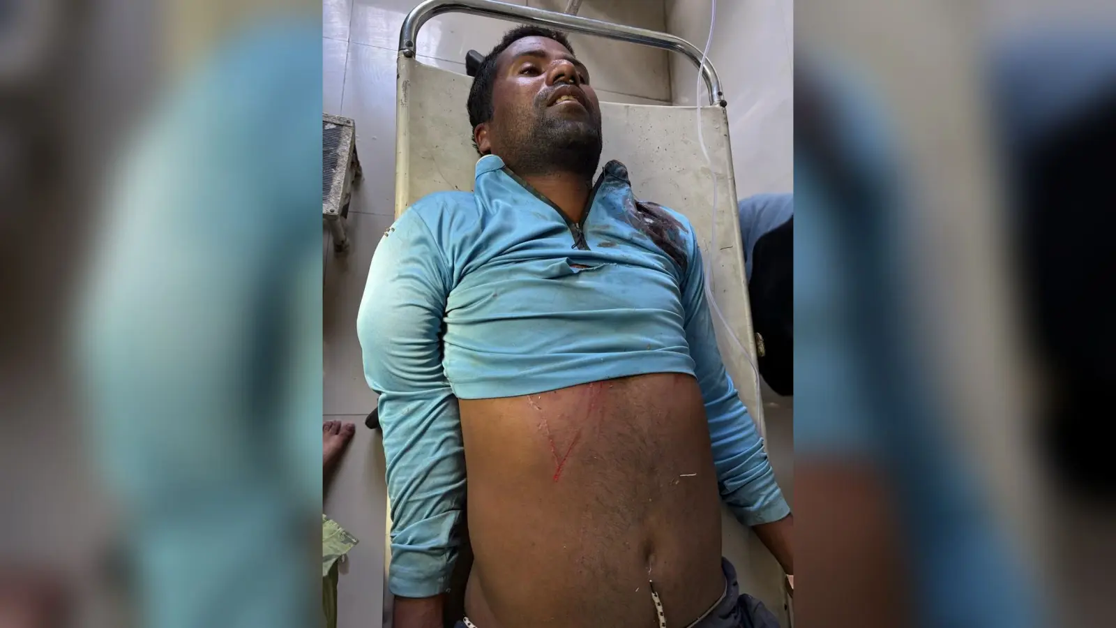 फंदे से लटका युवक, स्थिति गंभीर