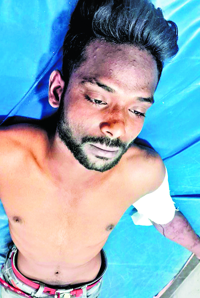 Rourkela News : राजगांगपुर के बांठूपाड़ा में फायरिंग, एक घायल, जांच में जुटी पुलिस