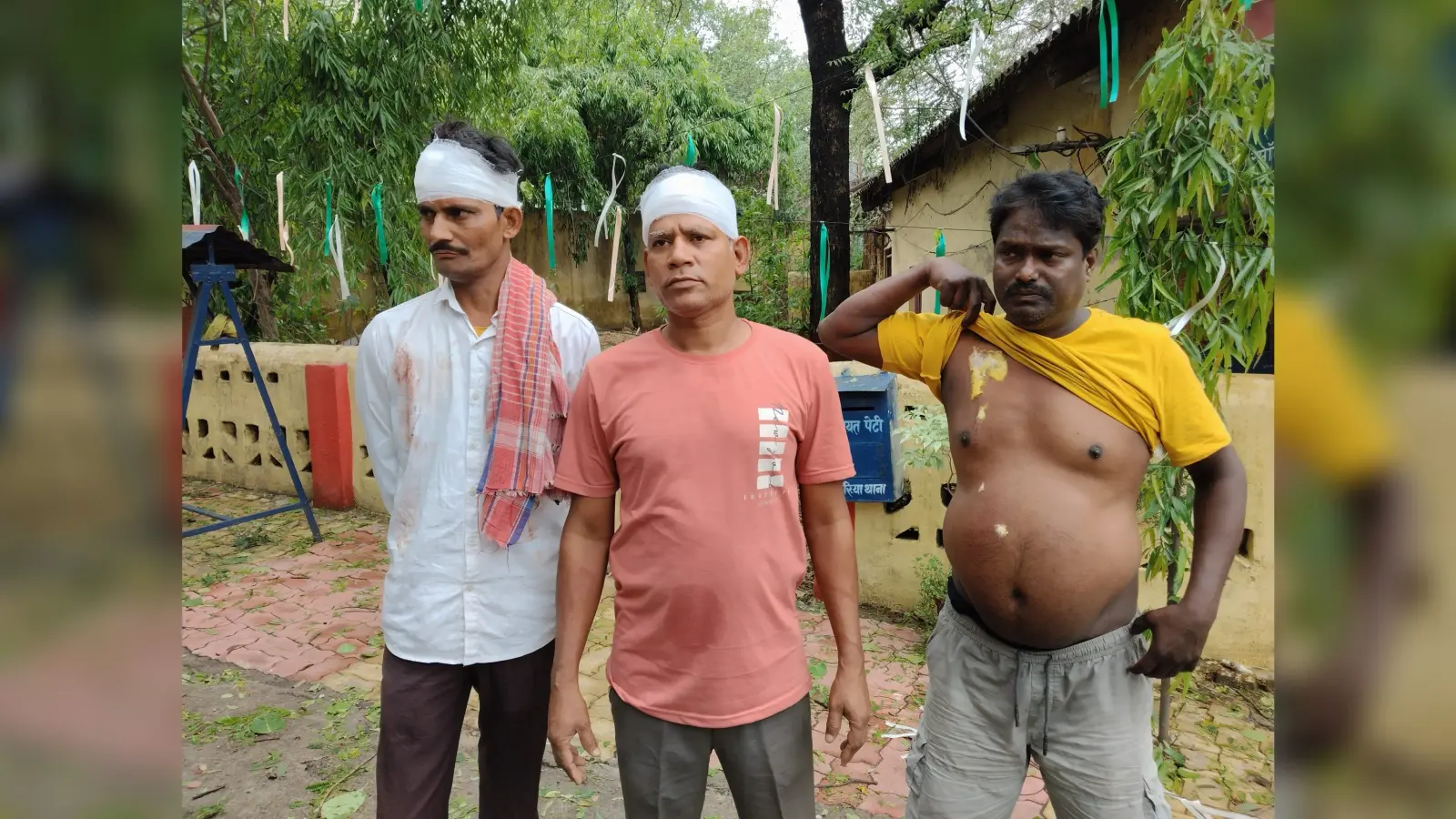 Dhanbad News : झरिया में छींटाकशी को ले दो पक्षों में जमकर मारपीट, कई घायल