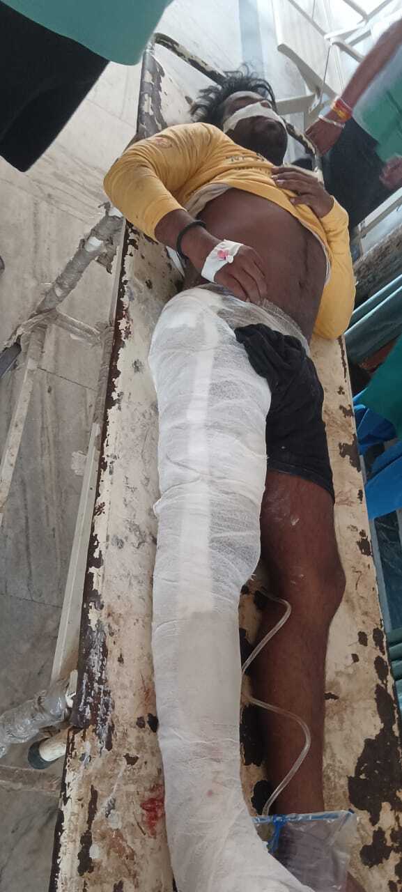 Accident : हादसे में मां की मौत, बेटा गंभीर रूप से घायल