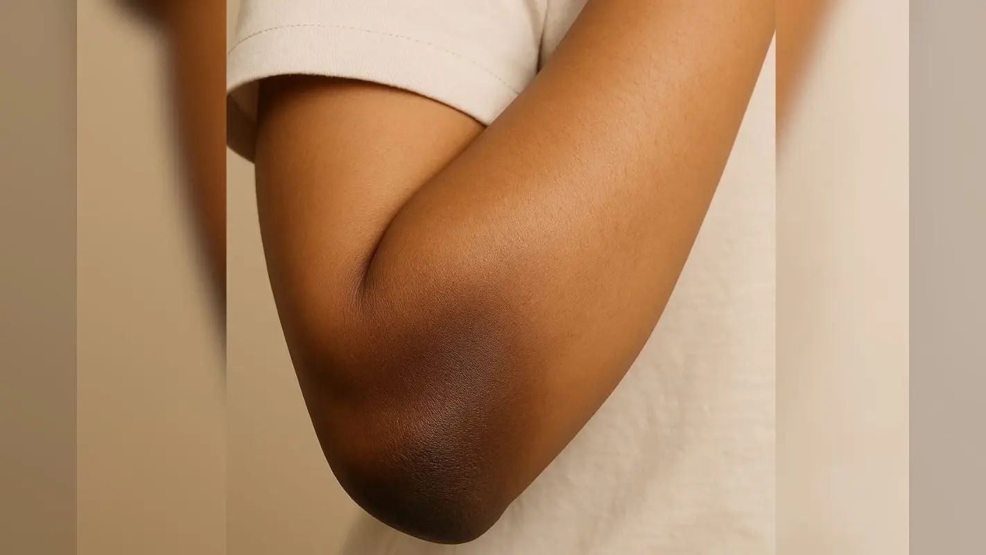 Skin Care Tips: काली कोहनियों से हैं परेशान? तो घर बैठे अपनाएं ये टिप्स