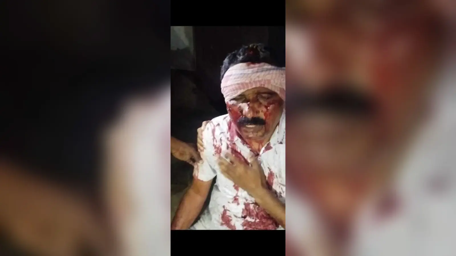 गोली लगने से अधेड़ व्यक्ति घायल, मामला दर्ज