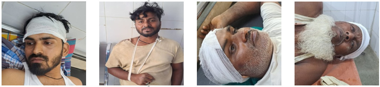 Giridih News: दो पक्षों में खूनी संघर्ष, 10 घायल, दो रेफर