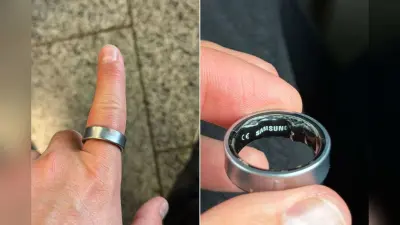 Samsung Galaxy Ring बना मुसीबत, पहनने वाले यूजर की हालत बिगड़ी, अस्पताल तक पहुंचा मामला
