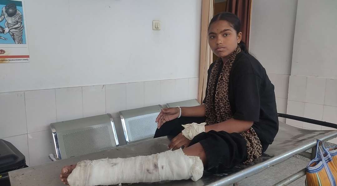 छत पर जाने के क्रम में फिसलकर गिरने से छात्रा जख्मी