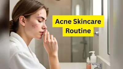 Acne Skincare Routine: पिंपल्स को करें कंट्रोल, पाएं साफ और ग्लोइंग स्किन इन आसान स्टेप्स से