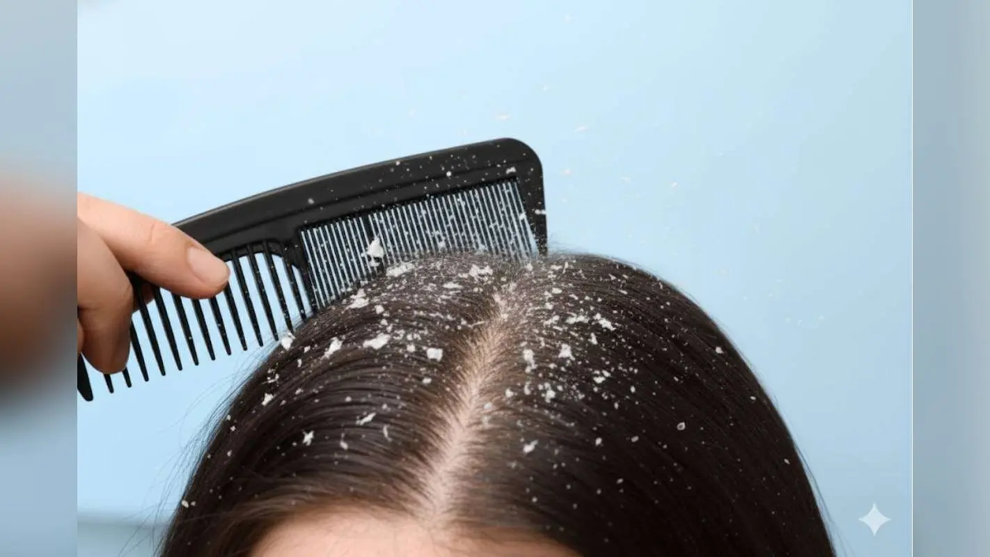 Hair Care Tips for Dandruff: डैंड्रफ से हो रही है सिर में खुजली? एक कटोरी दही से करें घरेलू इलाज, बाल बनेंगे मुलायम और चमकदार