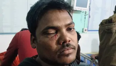 किशोरी को भगाने के विवाद में जमकर चले लाठी-डंडे, एक दर्जन घायल, तीन गंभीर