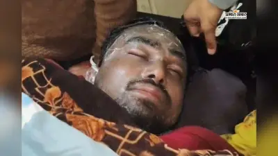 कहासुनी से हिंसक हुई बाप-बेटे की लड़ाई, पिता ने शरीर पर फेंका खौलता तेल